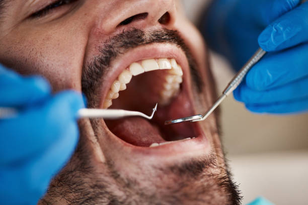 Best Emergency Tooth Extraction in Morristown, NJ