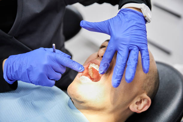 Best Emergency Root Canal Treatment in Morristown, NJ